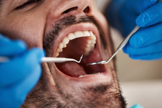 Dental Bonding in Jeffersonville, OH